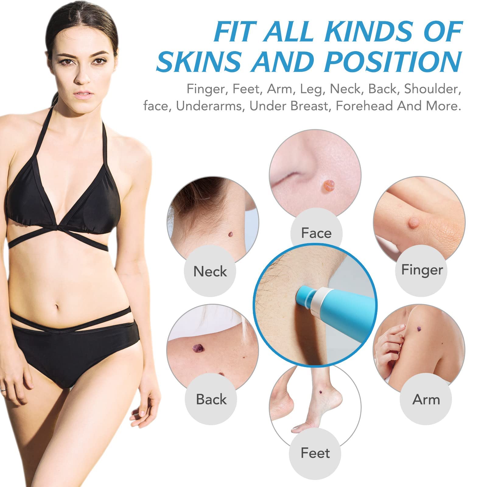 Auto Skin Tag Remover Kit for Face & Body
